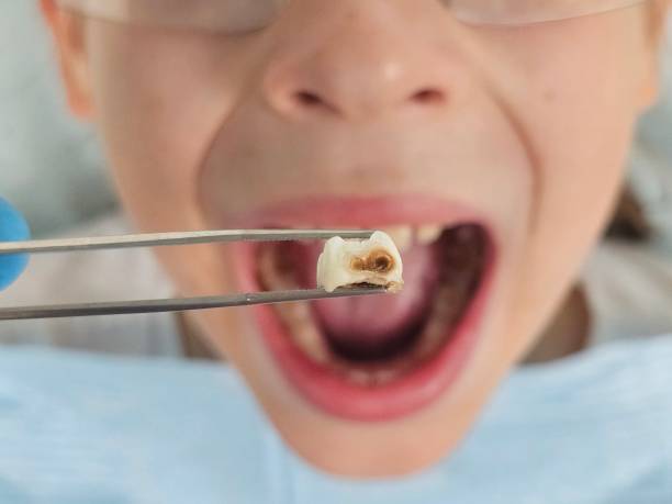 Best Emergency Cosmetic Dentistry in Hays, KS